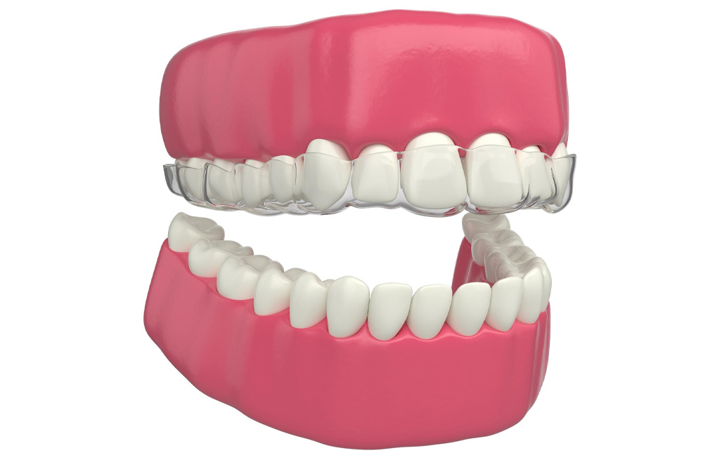 Why Fast Emergency Dental Care Matters